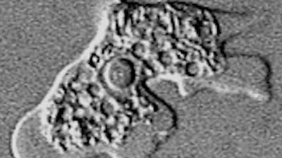 Brain Eating Amoeba Detected In South Bossier Parish Water System News Ktbs Com