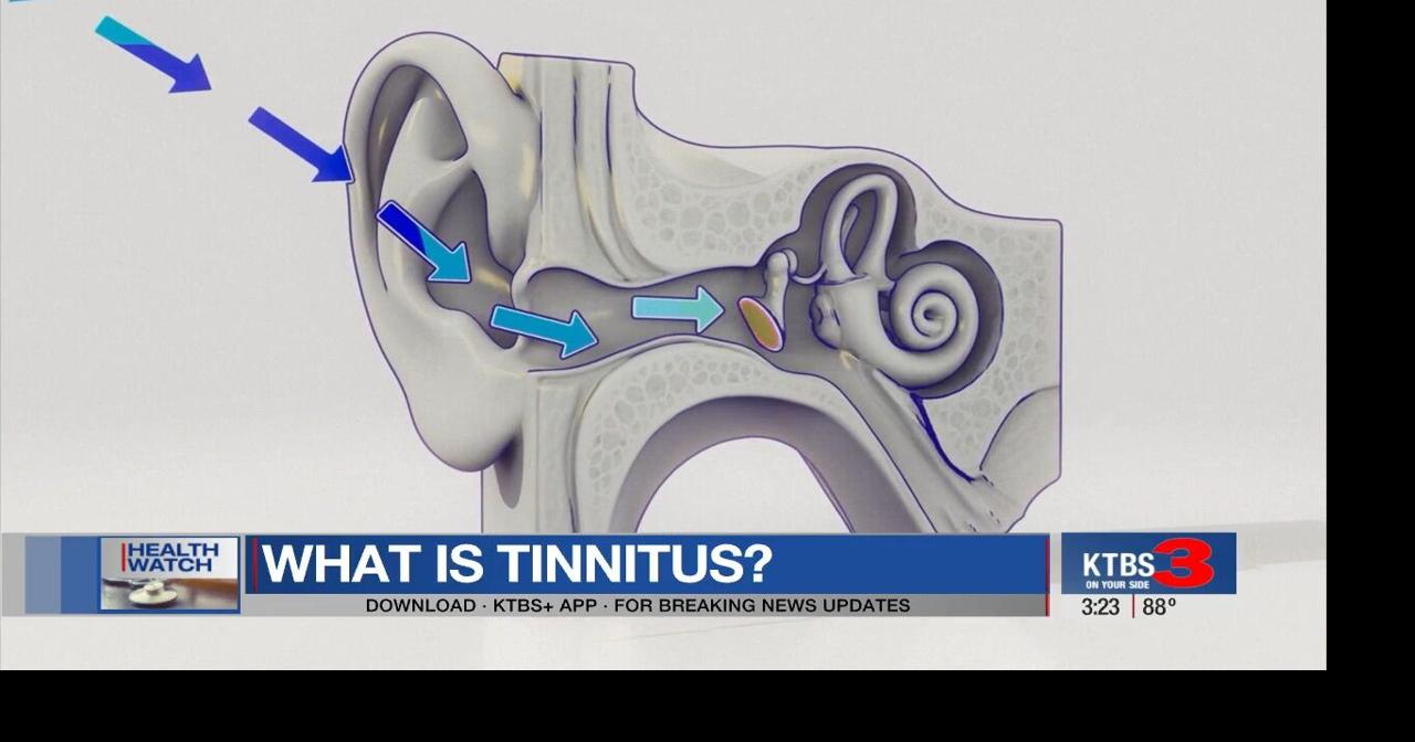 Ringing in the ears, known as tinnitus: What it is and how to treat it ...