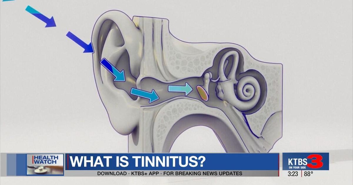 Pinking Ear Ringing in the ears, known as tinnitus: What it is and how to treat it ...
