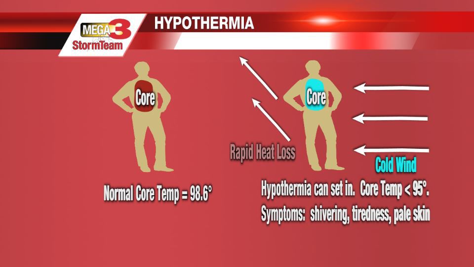 Dayz hypothermia что делать