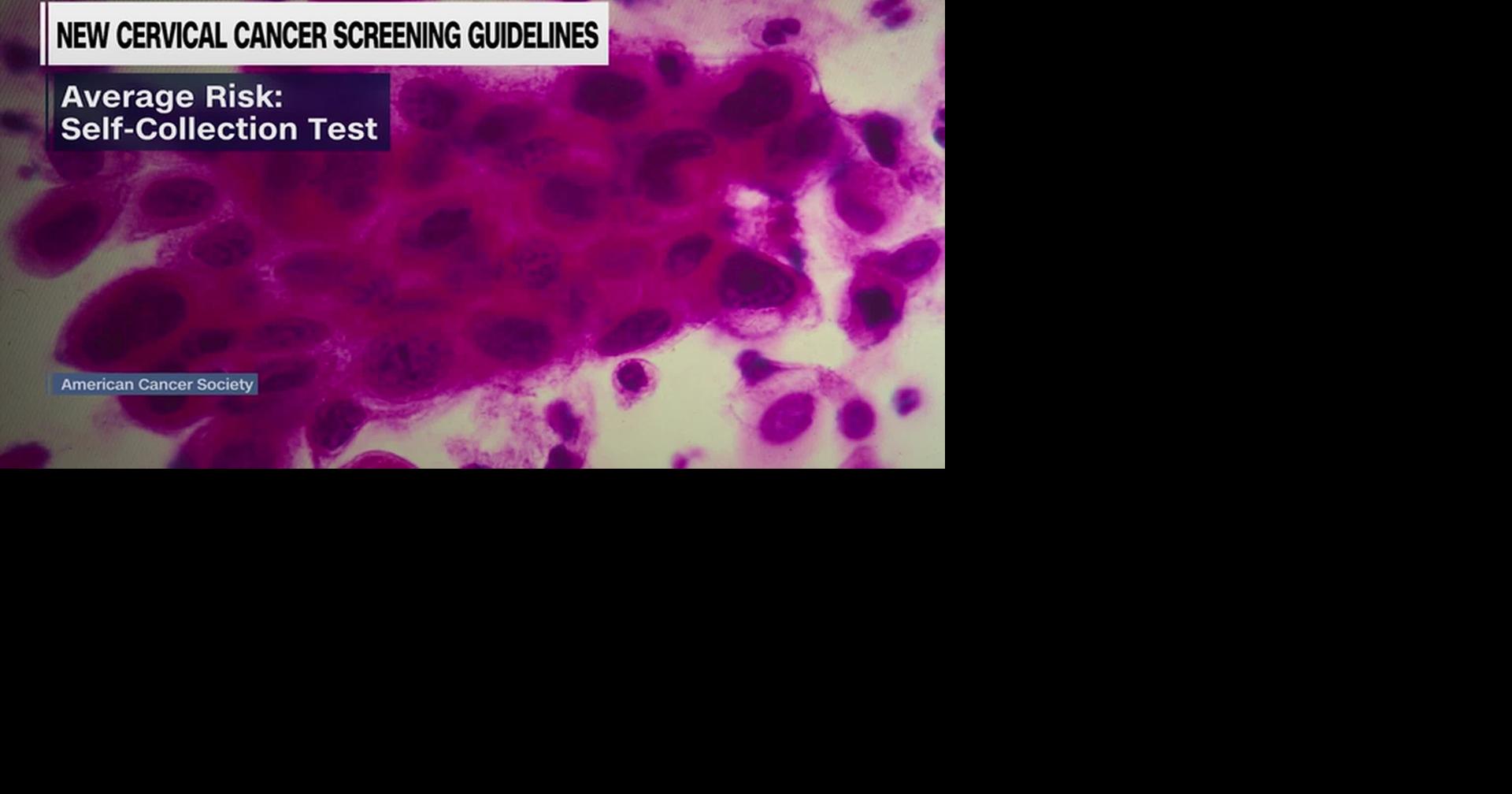HEALTH MINUTE: NEW CERVICAL CANCER SCREENING GUIDELINES