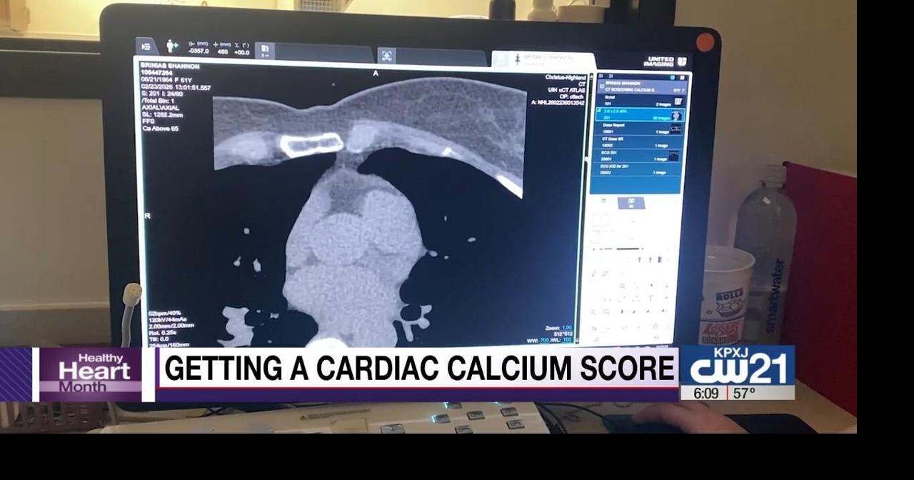 American Heart Month: Quick CT scan could help detect heart disease early