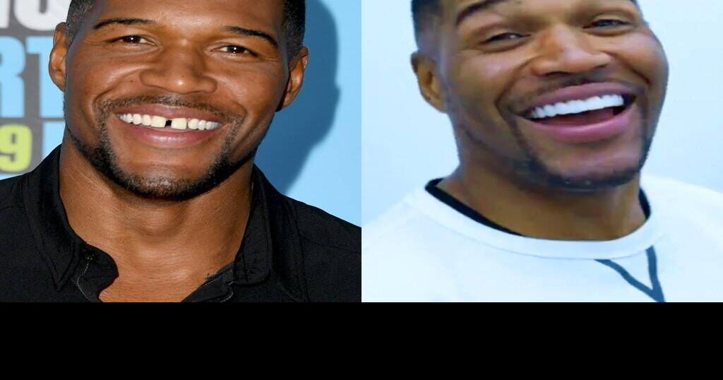 Michael Strahan reveals he's fixed trademark tooth gap 36 hours