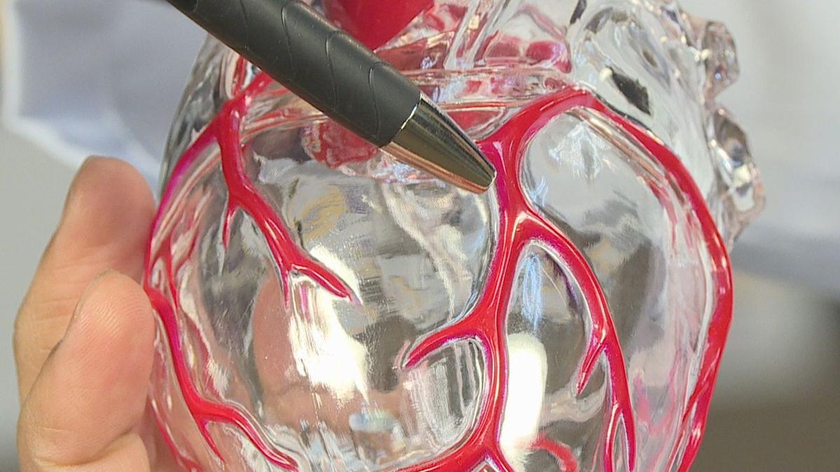 Shreveport businessman bounces back after triple bypass surgery