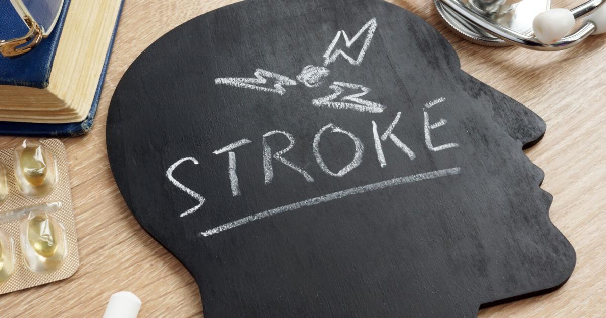 Exploring the Science Behind Strokes | Raise Stroke Awareness