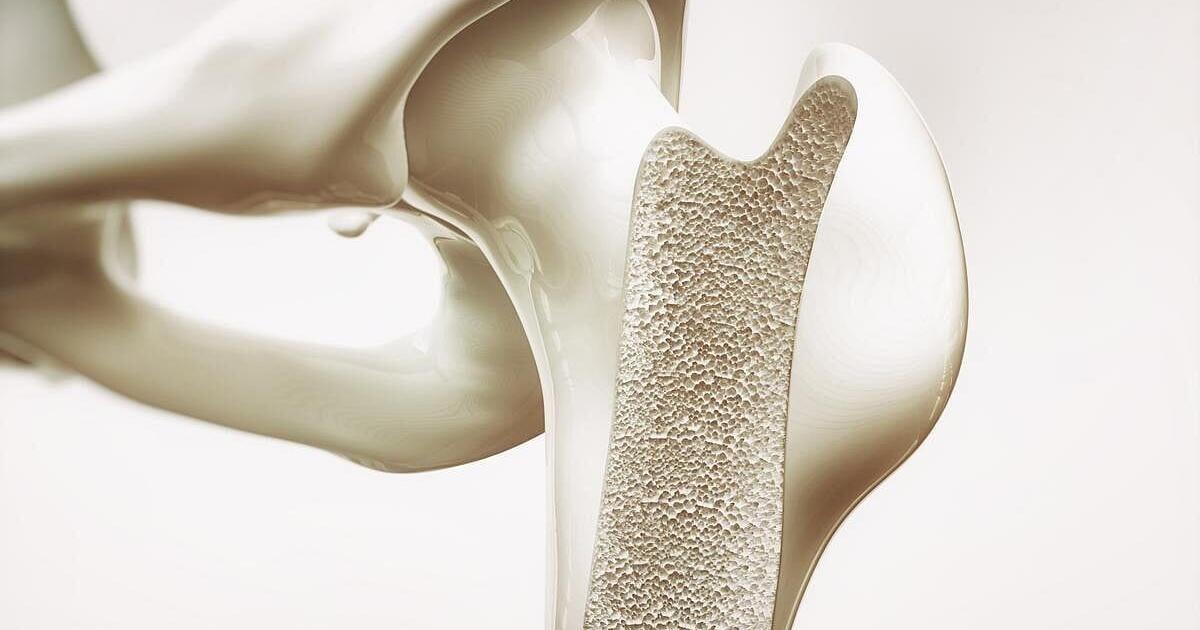 Weighted Vests Don’t Protect Bone Health In Dieting Seniors, Trial Says | Health