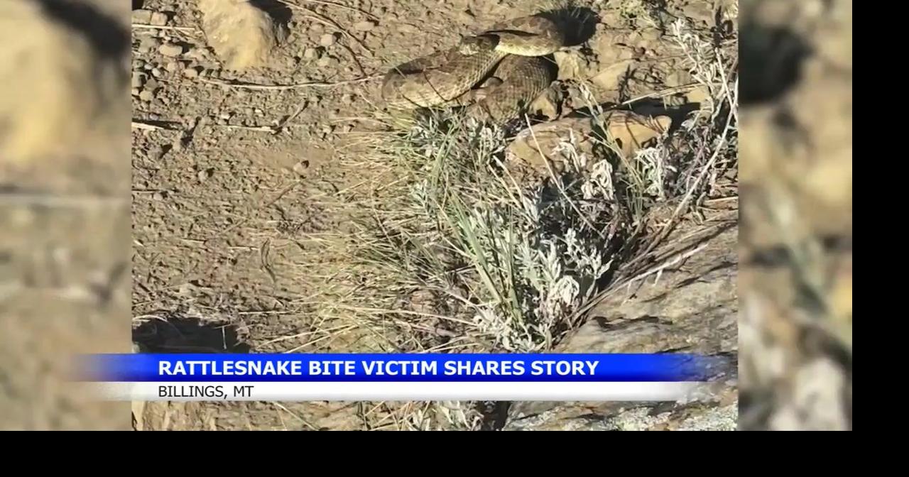 Billings runner bitten by rattlesnake shares her story to help others stay safe