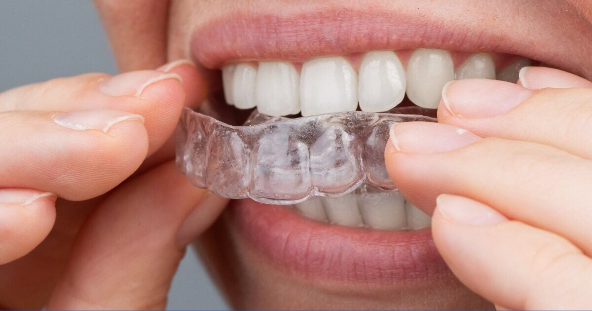 Zenyum Singapore Redefines Clear Aligner Therapy: a Smarter, More Accessible Alternative to Traditional Orthodontics