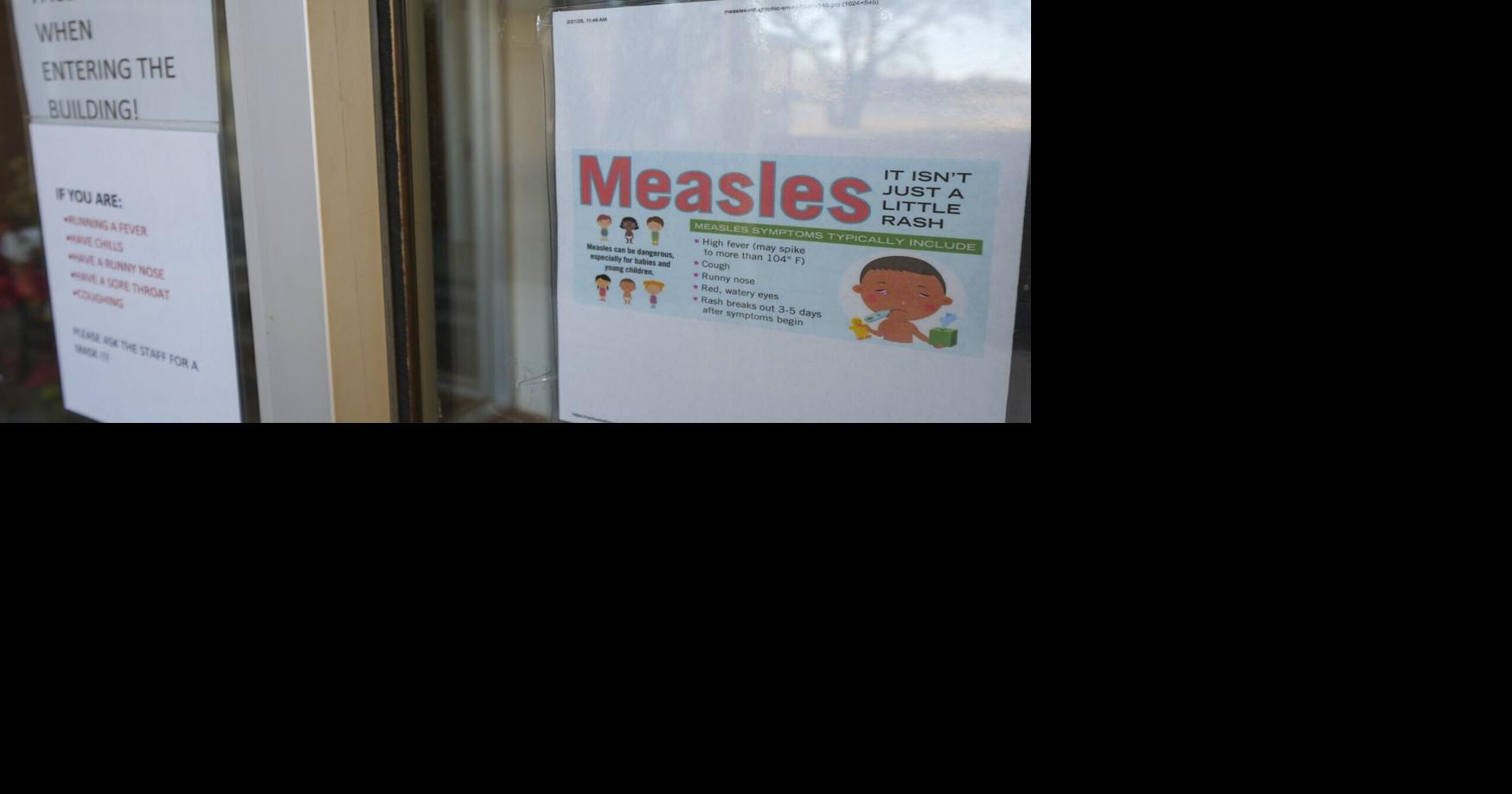 Health officials investigating first Cascade County measles case