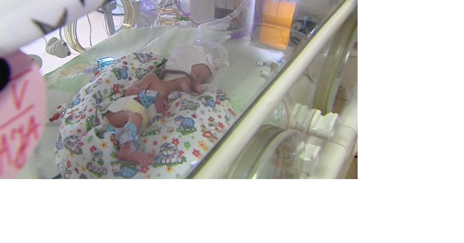 Woman Gives Birth To Polands First Sextuplets Billings News