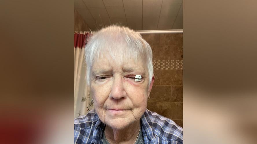 'Everything has changed' Users of recalled eye drops describe