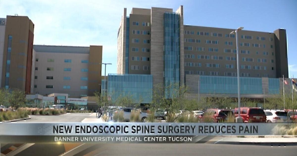 Aztec Surgery Banner UMC Tucson offers innovative spine surgery | News | kvoa.com