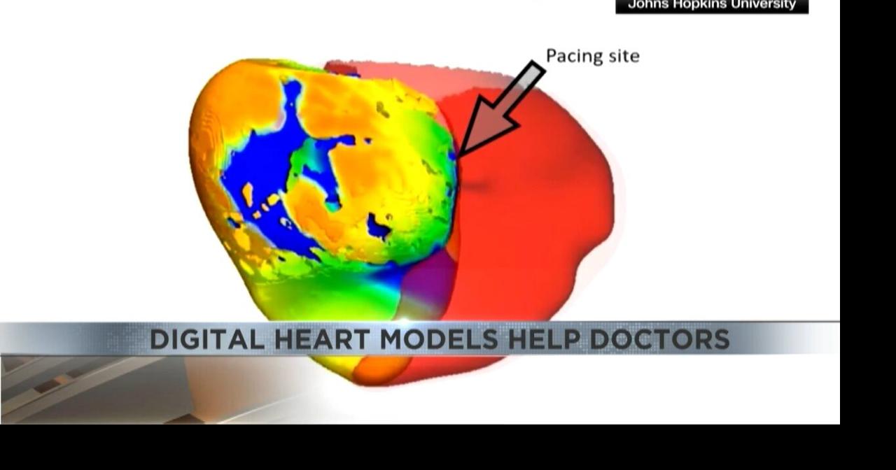 4 Your Health: Digital heart models help doctors | Video | kvoa.com