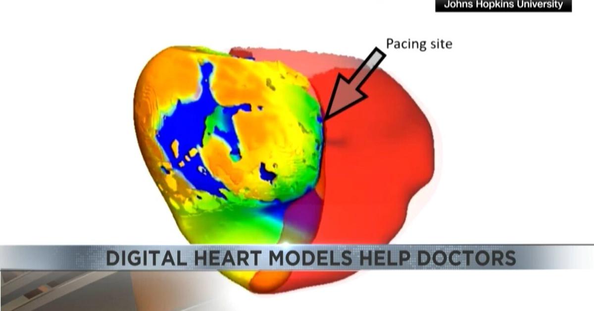 Digital Heart Map Examples 4 Your Health: Digital heart models help doctors | Video | kvoa.com