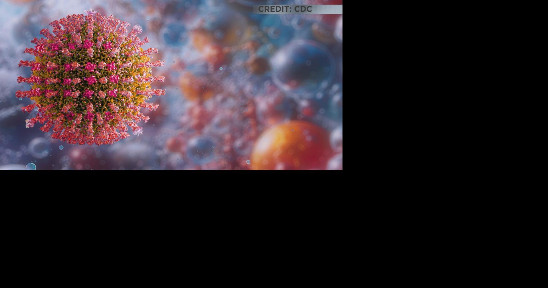 Tucson resident confirmed with measles, Pima County investigates