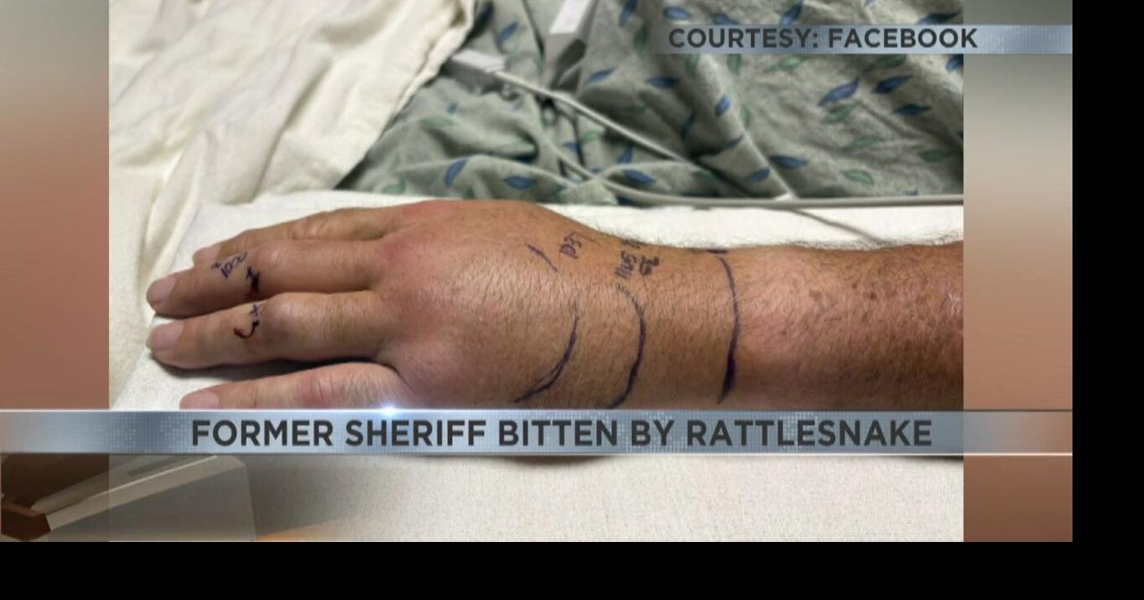 Former Pima County Sheriff recovering after rattlesnake bite | Video ...