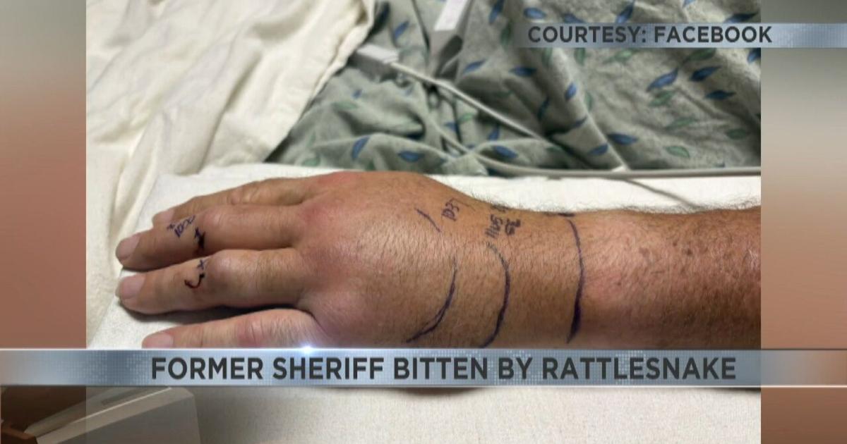 Pima Rattle Former Pima County Sheriff recovering after rattlesnake bite | Video ...