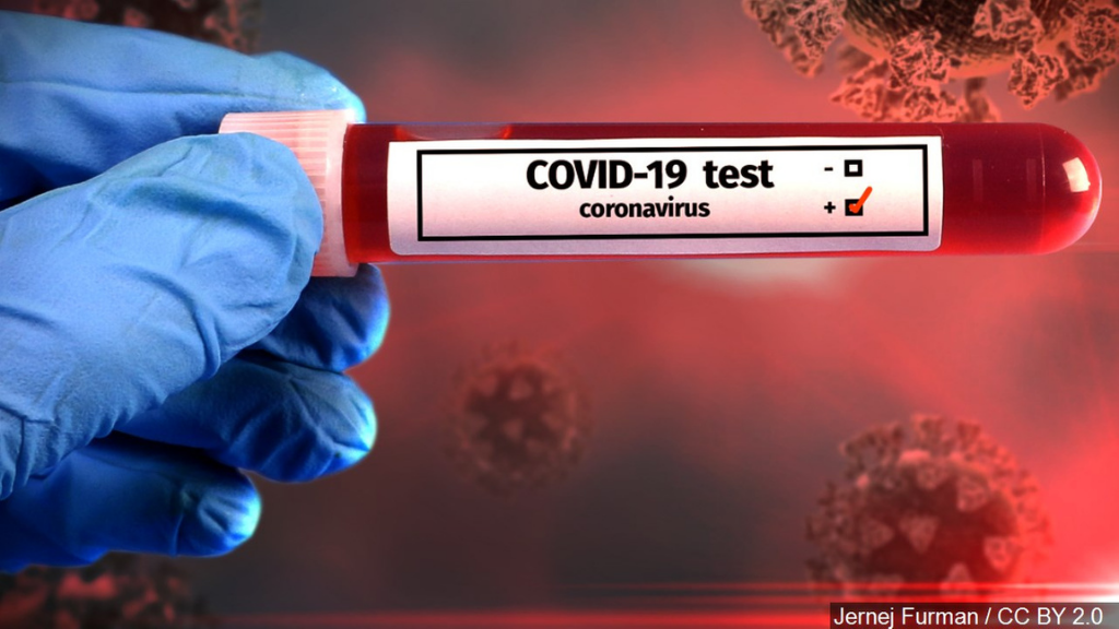 a negative blood type and covid