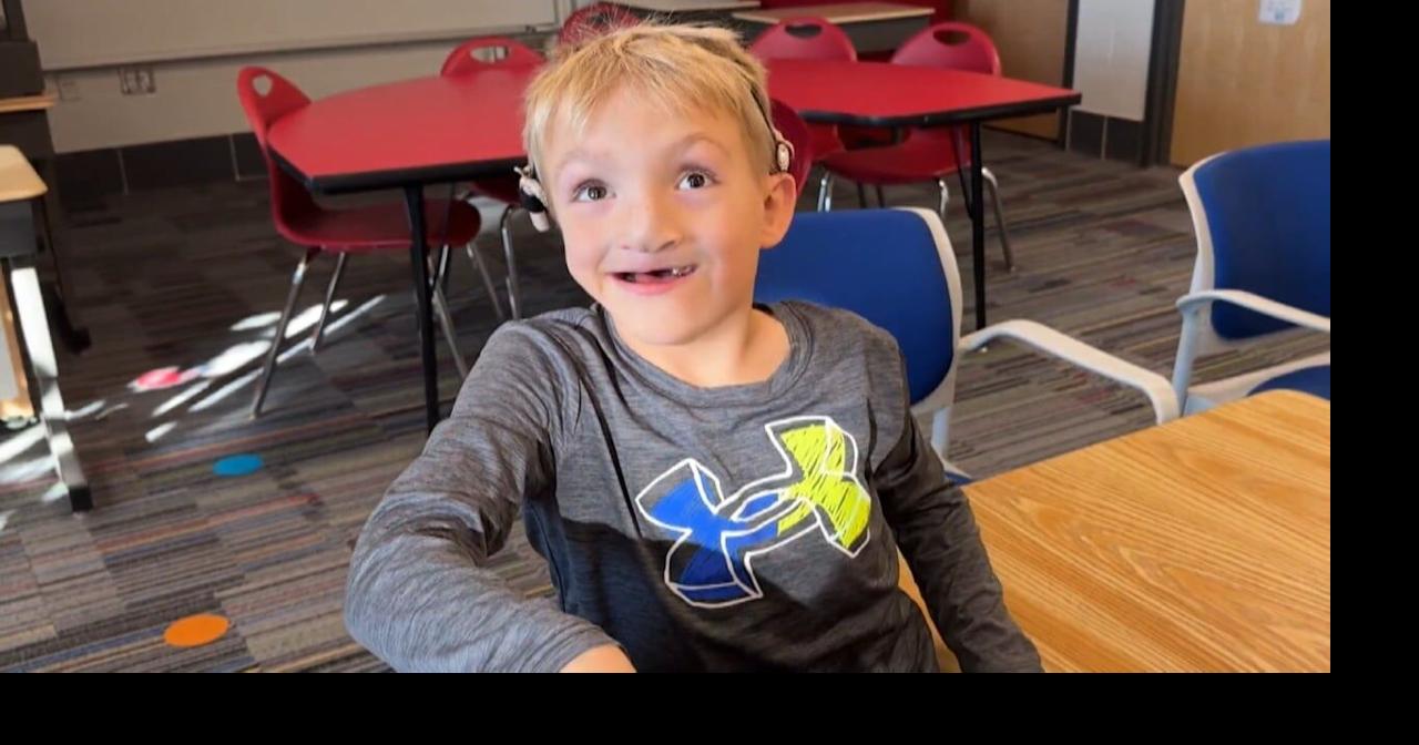 Iowans turn to UIHC Cochlear Implant Program to 'Hear' again amid ...