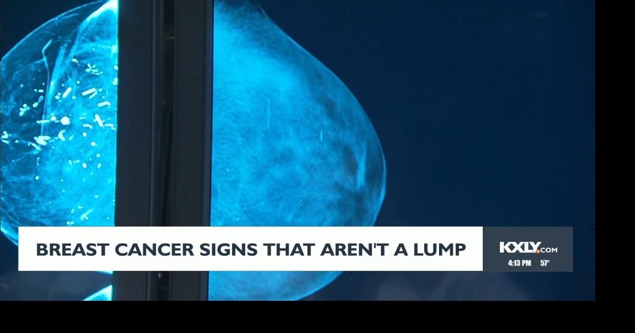 Breast cancer signs that aren't a lump | Video | kxly.com