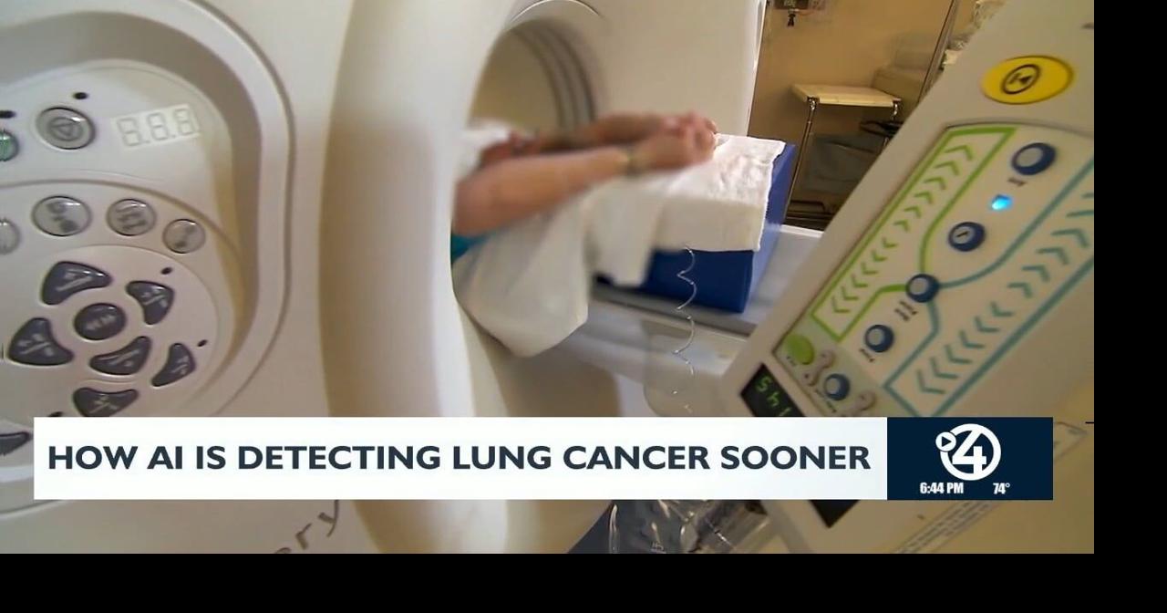How AI is detecting lung cancer sooner | Video | kxly.com
