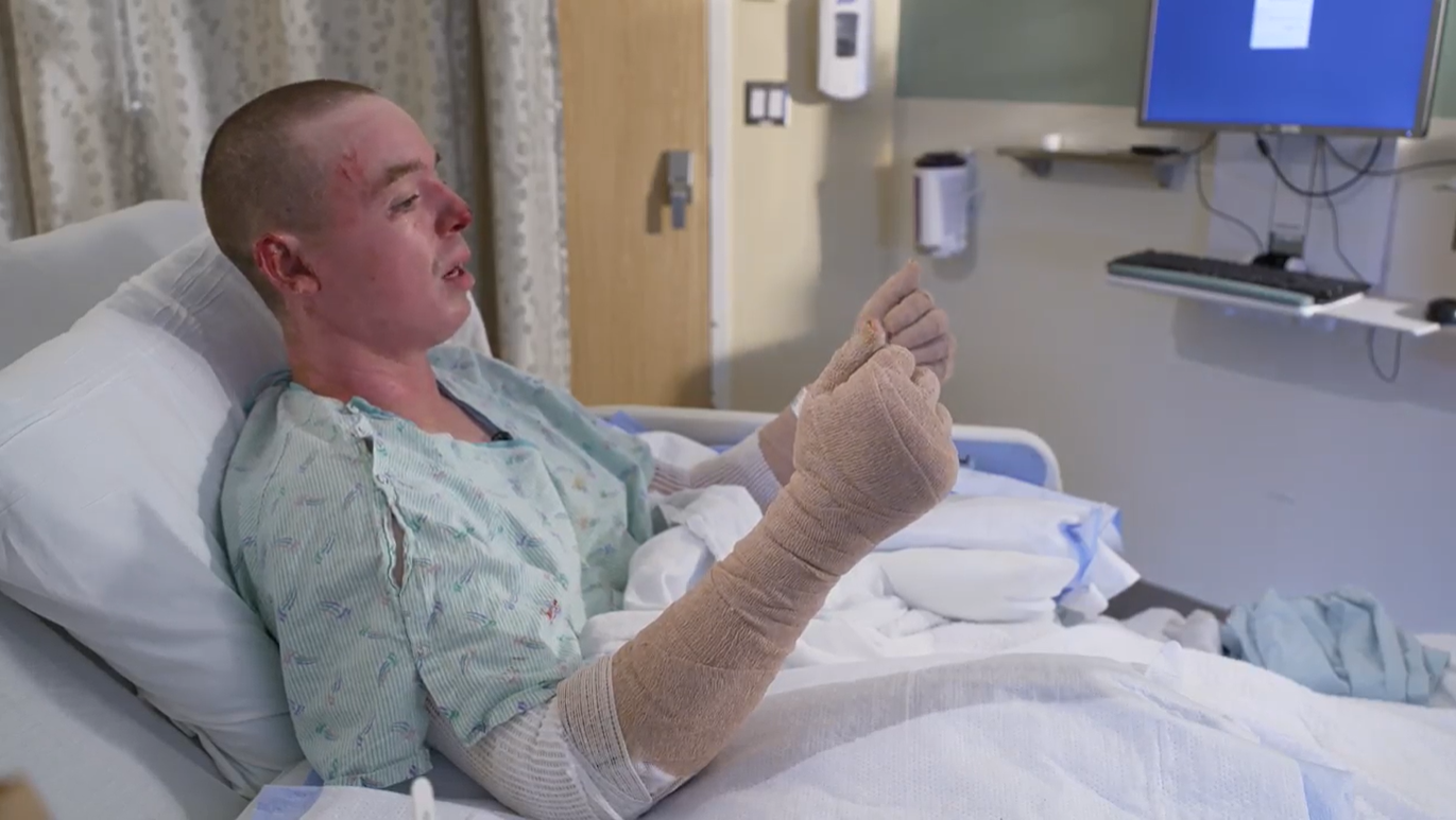 Man Burned By Oregon Road Fire Recovering In Hospital, Shares Survival ...