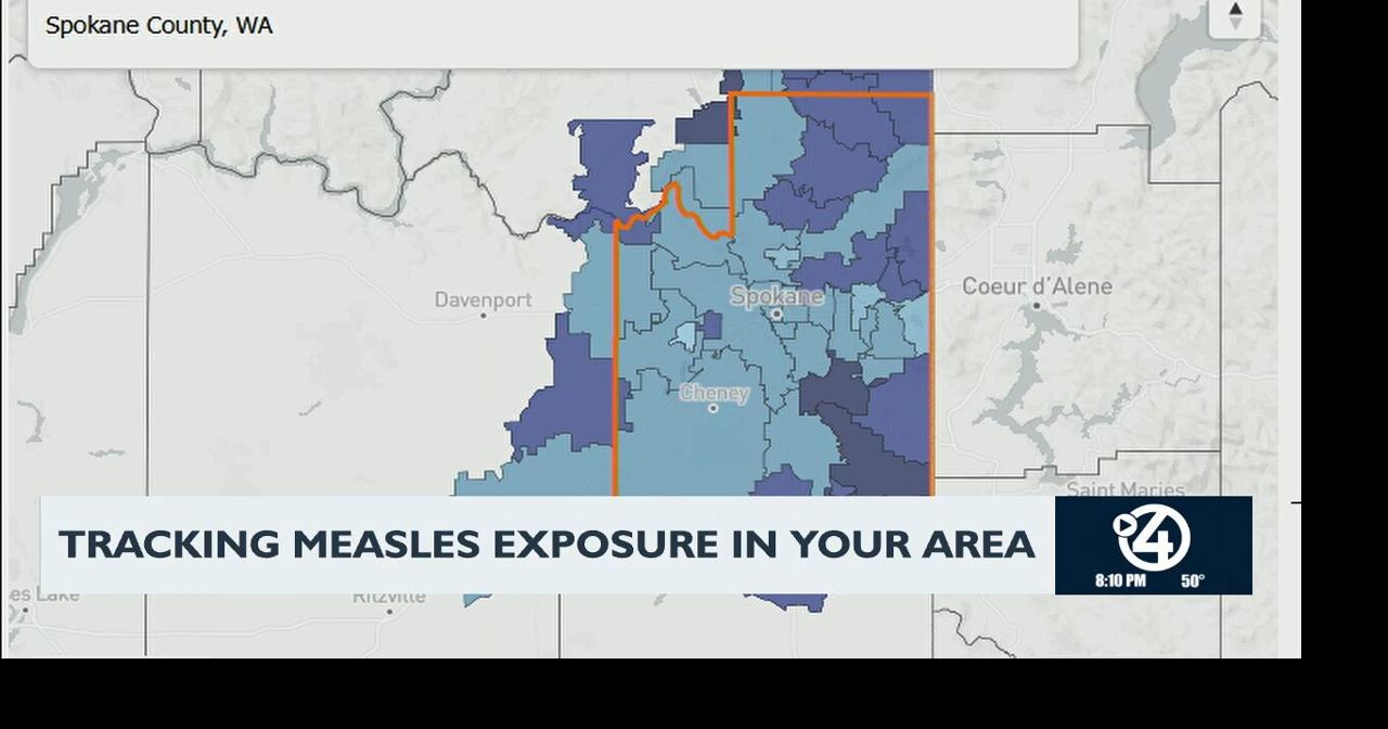 Tracking measles exposure in your area | Video | kxly.com