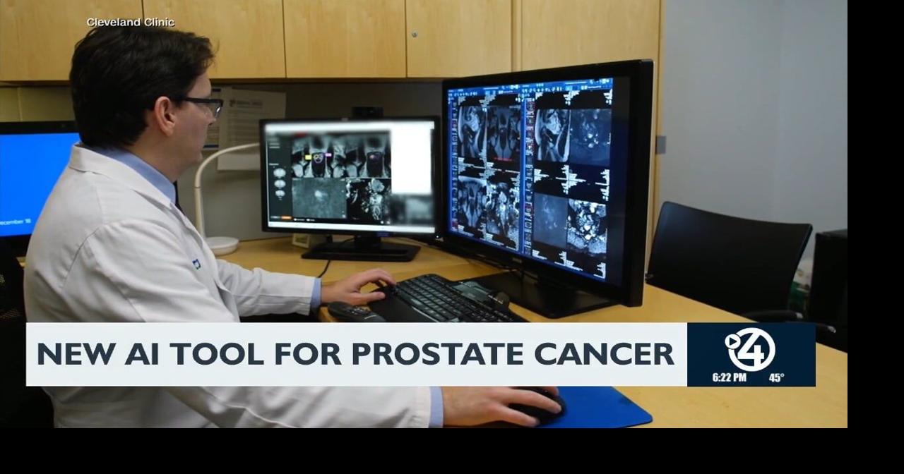 New AI tool for prostate cancer | Video | kxly.com
