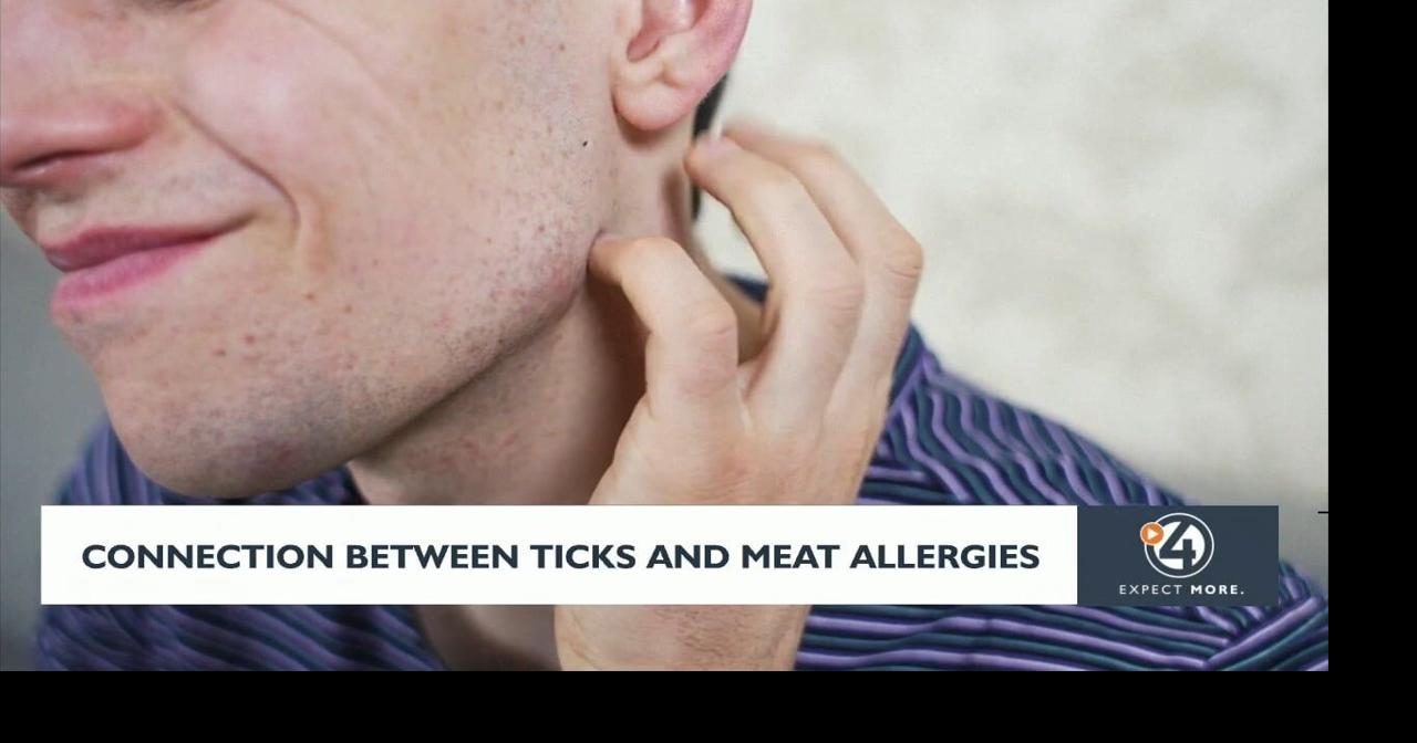 Connection between ticks and meat allergies | Video | kxly.com