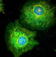Scientists discover how tumors play dead to dodge chemotherapy