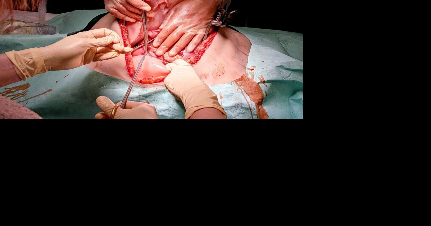 New 3D-printed ‘bleeding’ torsos used to train trauma surgeons