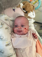 Premature baby undergoes new heart operation