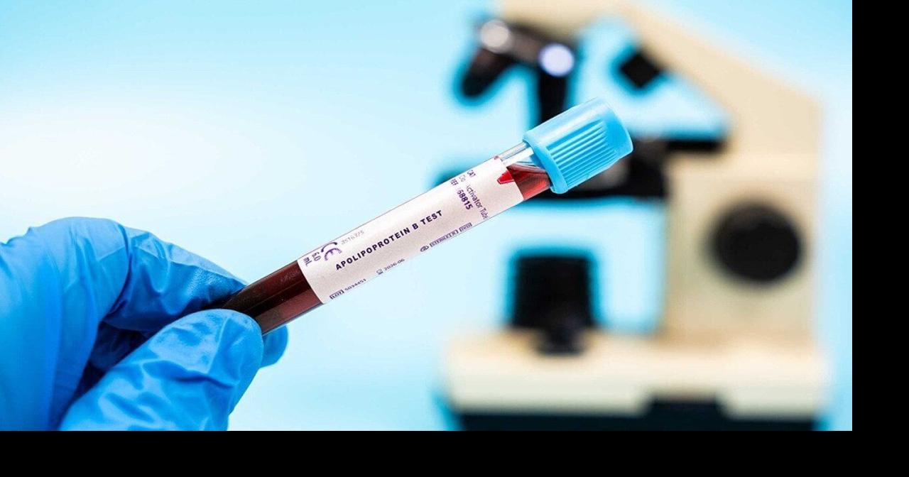 This heart health test spots risks better than cholesterol