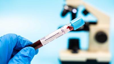 This heart health test spots risks better than cholesterol