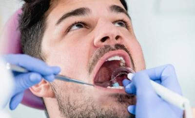 How to Remove Tartar from Your Teeth