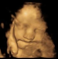 Study finds toddlers can remember smells from the womb