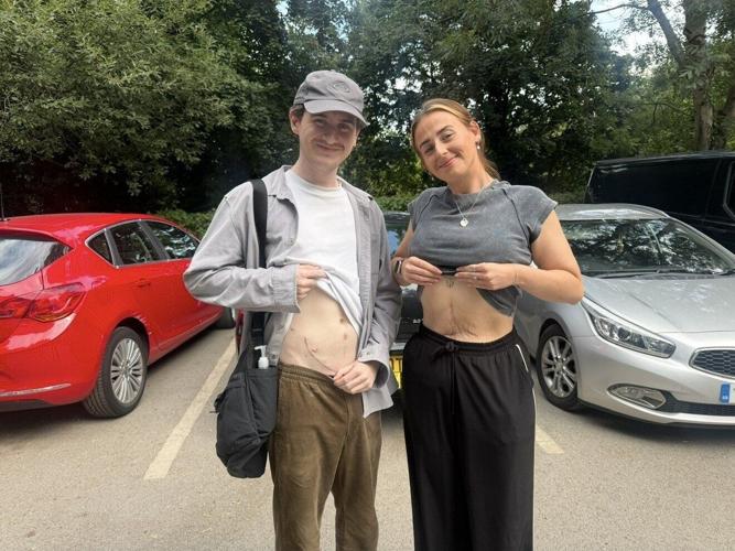 Sister saves brother’s life donating a kidney after rare diagnosis
