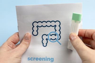 Screening is essential to prevent and effectively treat colorectal cancer.
