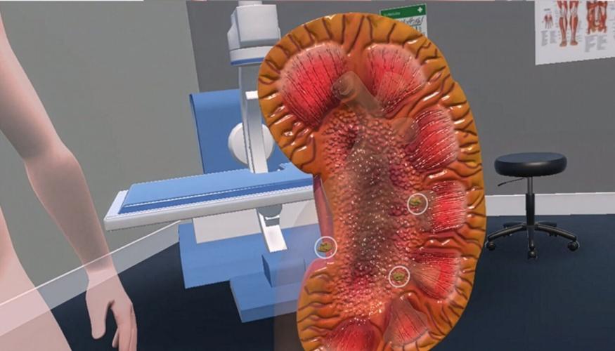 Virtual reality could reduce anxiety for patients before medical procedures