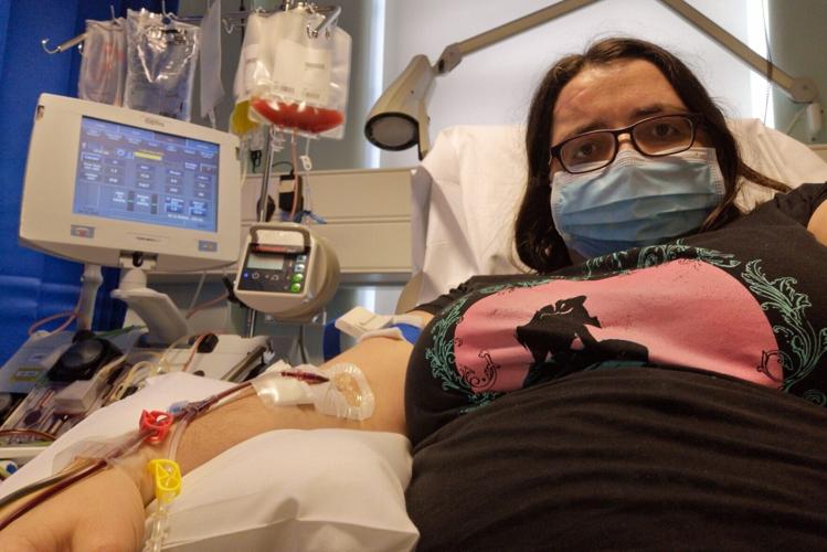 “I thought my lump was a cyst, but it was actually deadly cancer eating my skull”