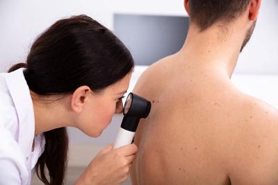 AI Boosts Skin Cancer Diagnoses, Study Says