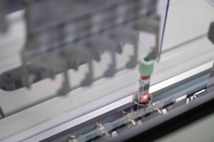 New blood test can spot one of deadliest forms of cancer at its earliest stages