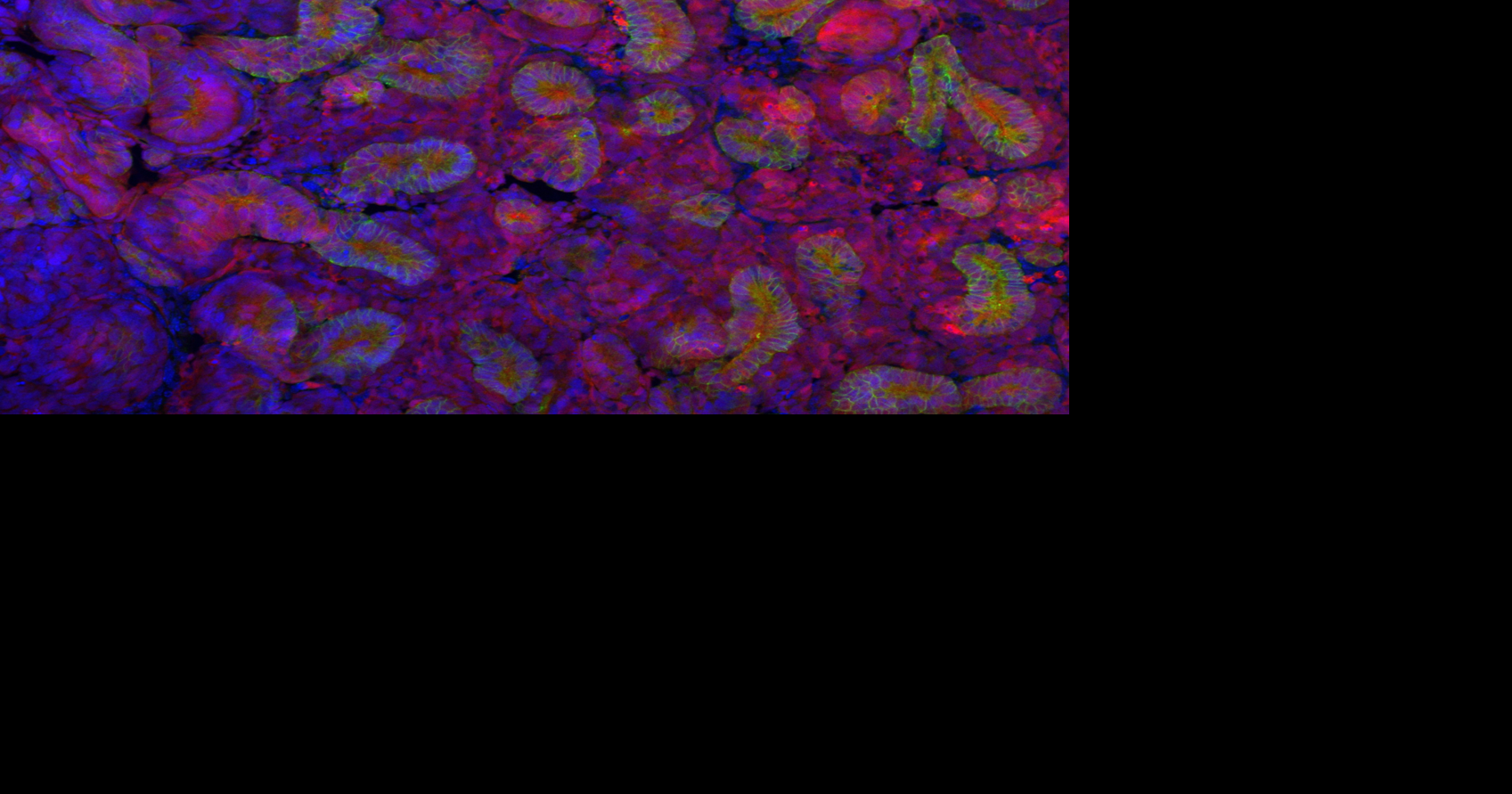 Rat kidneys grown in mice offer new hope for transplant patients