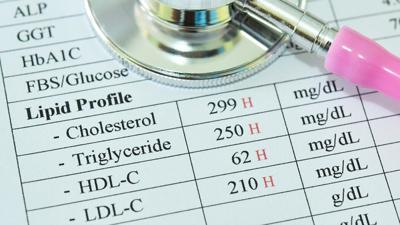 Common medications for high cholesterol