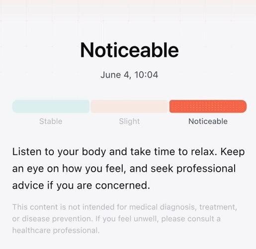 RingConn Gen 3 Smart Ring Opens for Pre-Order: Bringing Vascular Insights to Effortless Everyday Wear