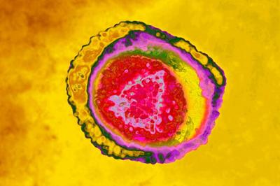 Varicella zoster virus, also known as human herpesvirus 3, causes chickenpox and shingles.