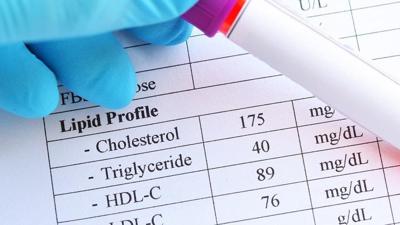 New ways to lower cholesterol