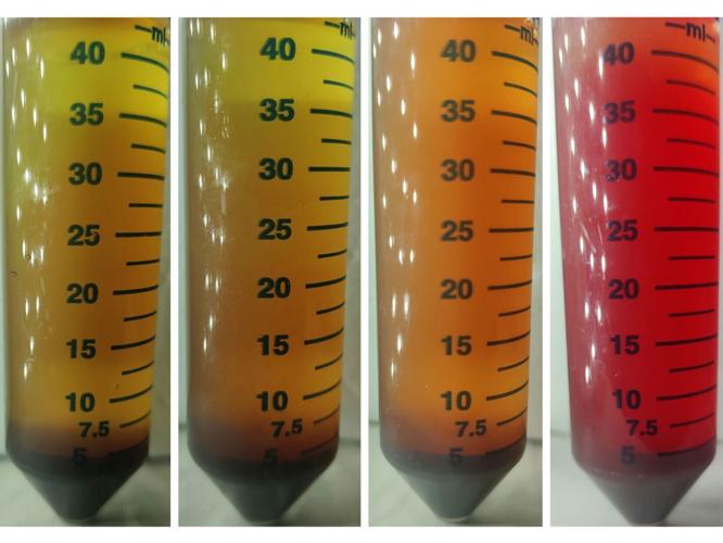 Sepsis could be diagnosed in just seven hours rather than days, suggests study