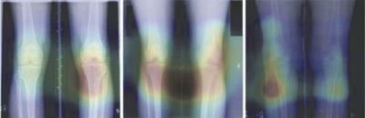 Knee X-rays