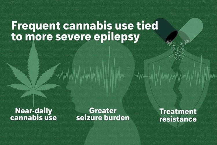 Cannabis triggers more severe epilepsy, suggests new study
